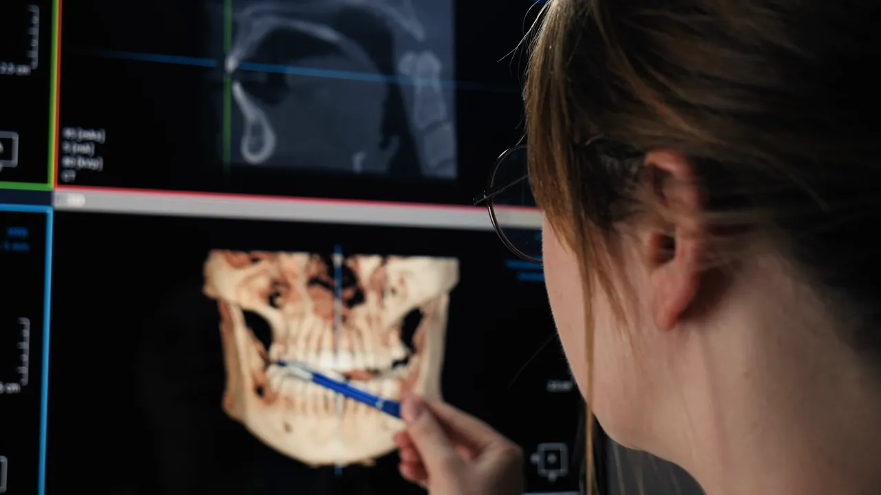 Diagnóstico multidisciplinar del desarrollo craneofacial en Boca a Boca