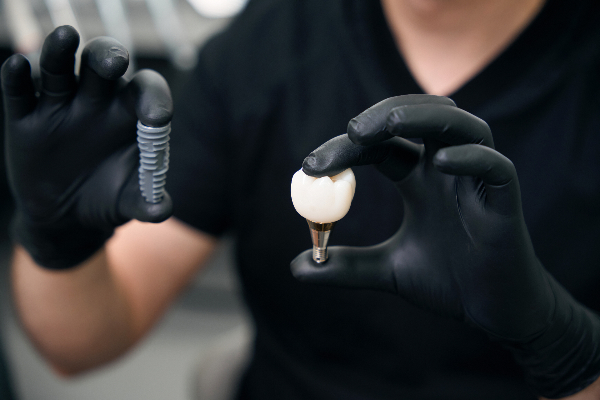 Implantes dentales